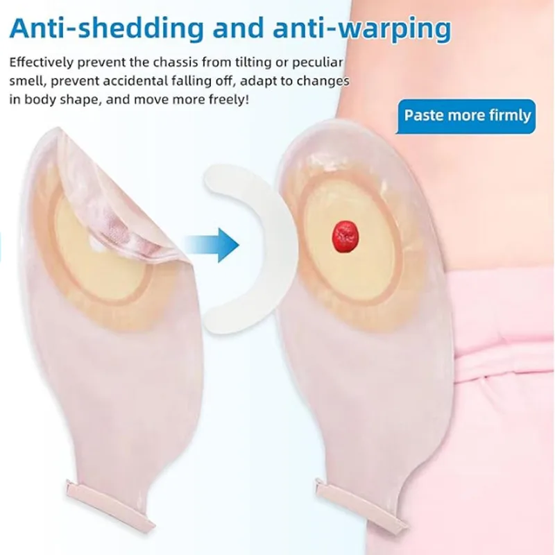 แถบเสริมความแข็งแรงสำหรับถุงออ - Medical Tape บทวิจารณ์และราคา